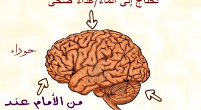 حقيقة علاج الصداع حسب مكان الوجع