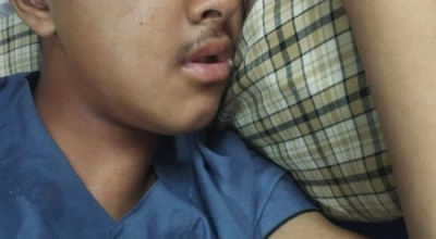 رصاصة في رأس علاء سلبته طفولته