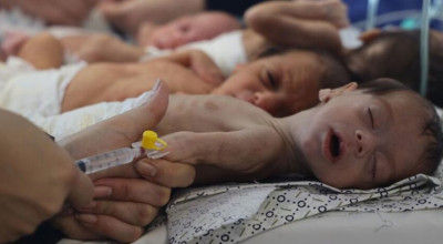 أصوات أمعاء الرُضع الخاوية تعلو أصوات الصواريخ في غزة