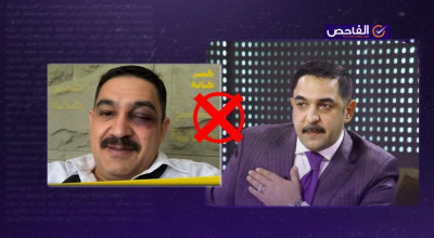 الصورة مفبركة ولا تظهر كدمات على عين النائب الدهلكي بعد مشاجرة البرلمان!