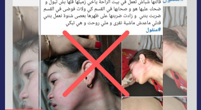 الصورة المتداولة لطفلة معنفة لا تعود لطفلة تونسية بل لطفلة مصرية