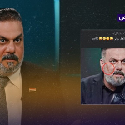 &#8220;كدمات على وجه علاء الحيدري بعد مشاجرة البرلمان&#8221;.. هذه الصورة مفبركة!