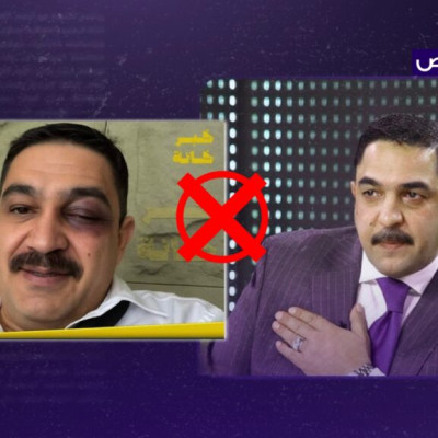الصورة مفبركة ولا تظهر كدمات على عين النائب الدهلكي بعد مشاجرة البرلمان!