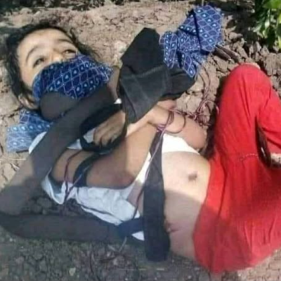 حقيقة الصورة المتداولة لجثة طفلة عُثر عليها في تعز