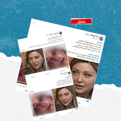 ما حقيقة الادعاء حول تعذيب لونا الشبل على يد الحرس الثوري الإيراني قبل مقتلها؟