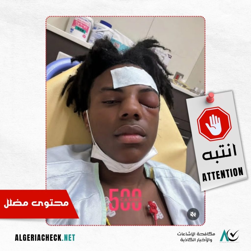 الإعتداء على اليوتوبر الأمريكي “سبيد” في الجزائر.. إليك الحقيقة