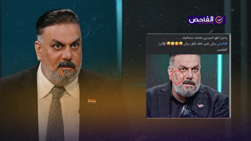 &#8220;كدمات على وجه علاء الحيدري بعد مشاجرة البرلمان&#8221;.. هذه الصورة مفبركة!
