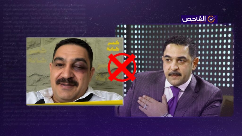 الصورة مفبركة ولا تظهر كدمات على عين النائب الدهلكي بعد مشاجرة البرلمان!