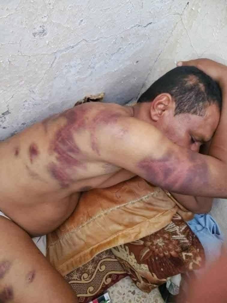 حقيقة تعذيب مواطن في مأرب الصورة المتداولة تعود لحادثة في شبوة عام 2023