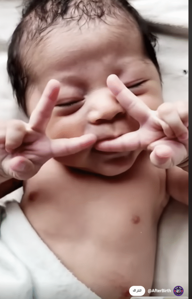 فيديو طفل حديث الولادة يرفع شارة النصر ليس من غزة