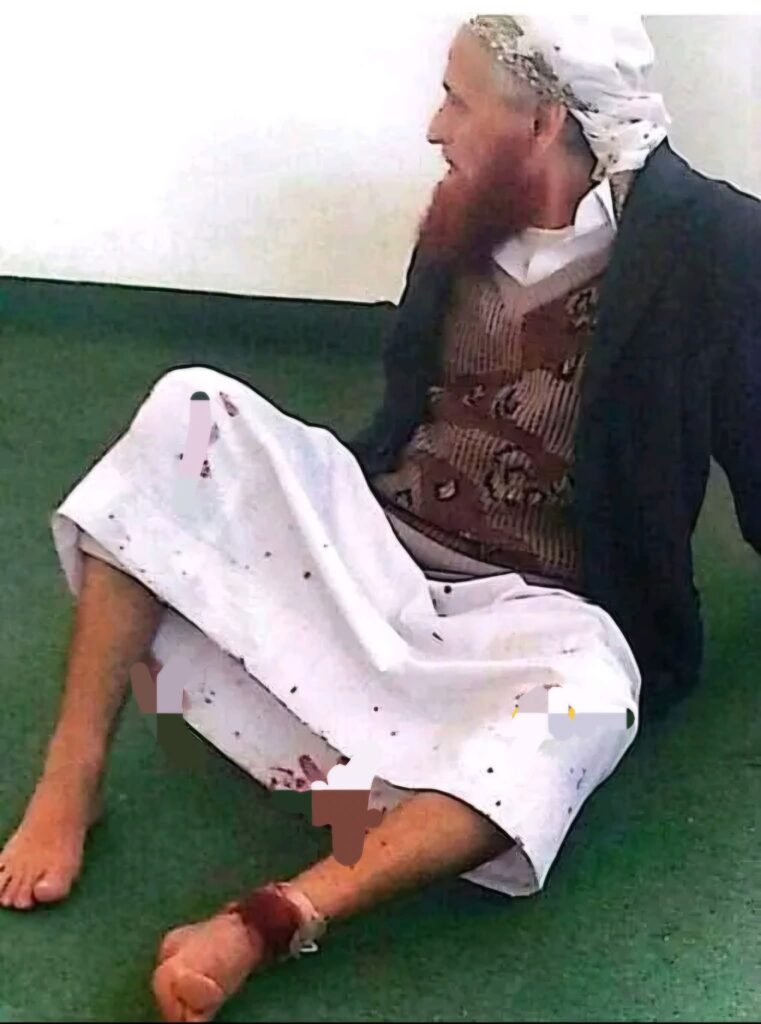 صورة الشيخ علي الأهنومي وهو مصاب قديمة وتعود لحادثة عام 2016